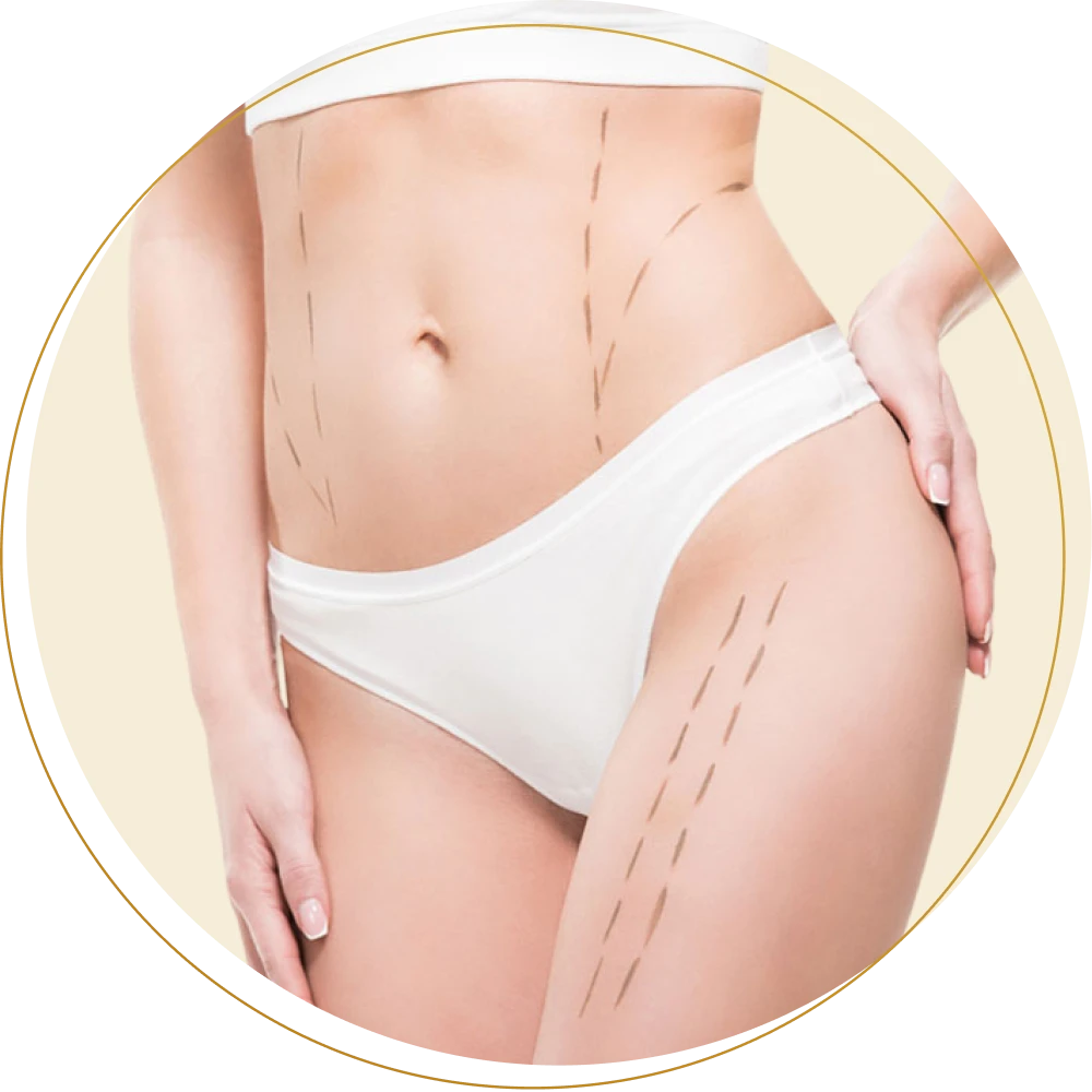 img body contouring body sculpting