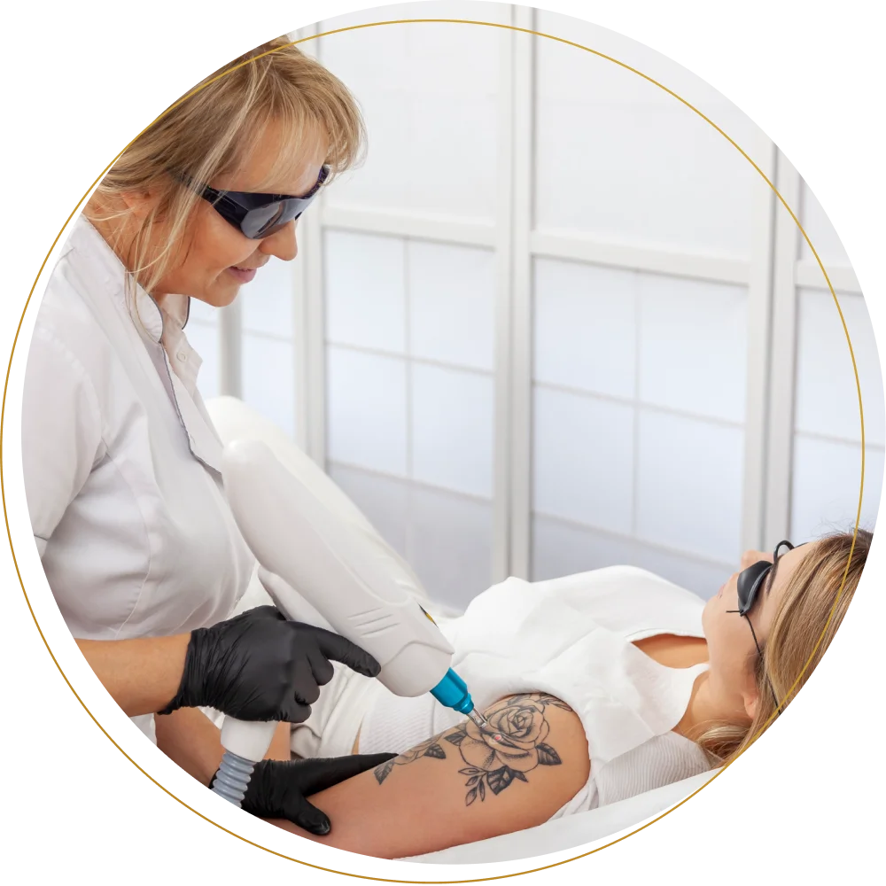 tattoo removal benefits